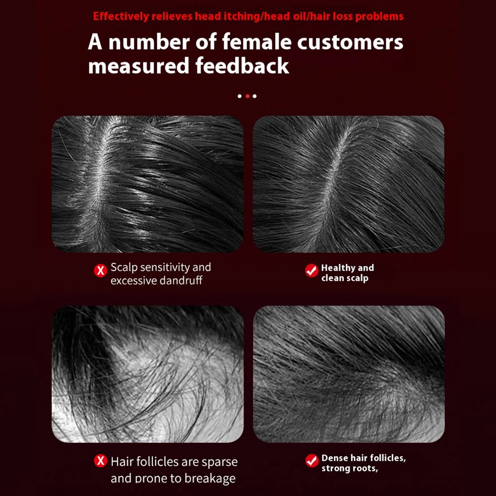 Electric Massage Comb Shiatsu Kneading Scalp Massager 630nm Red Light Scalp Medicine Applicator Hair Care Comb Anti Hair Loss